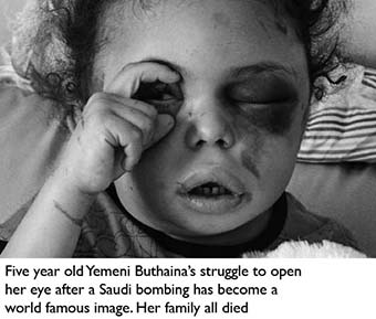 Yemen thousands of children dying weekly