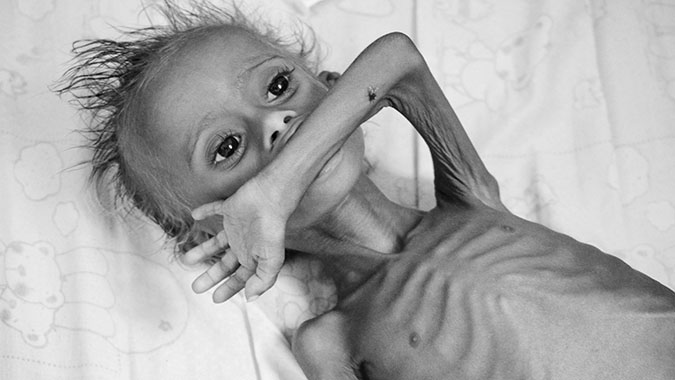 Yemen - deliberate destruction leaves 12million facing famine